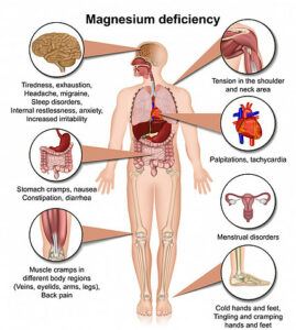 A diagram of the human body showing all of the areas effected by magnesium deficiency.