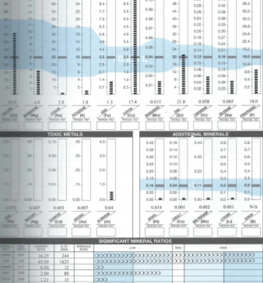 An example of a Hair Tissue Mineral Analysis test. 