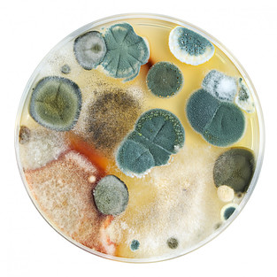 A petri dish filled with mold.