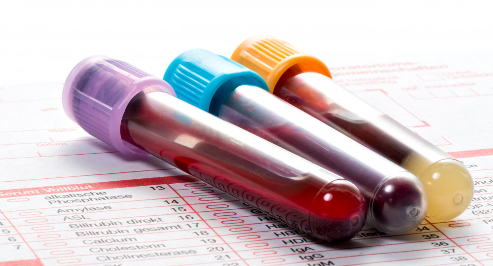 Blood test tubes.